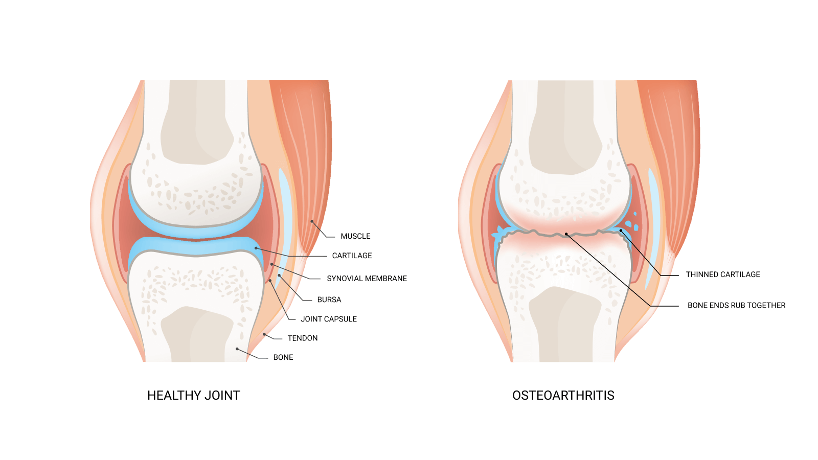 Overview EMS Pain Therapy